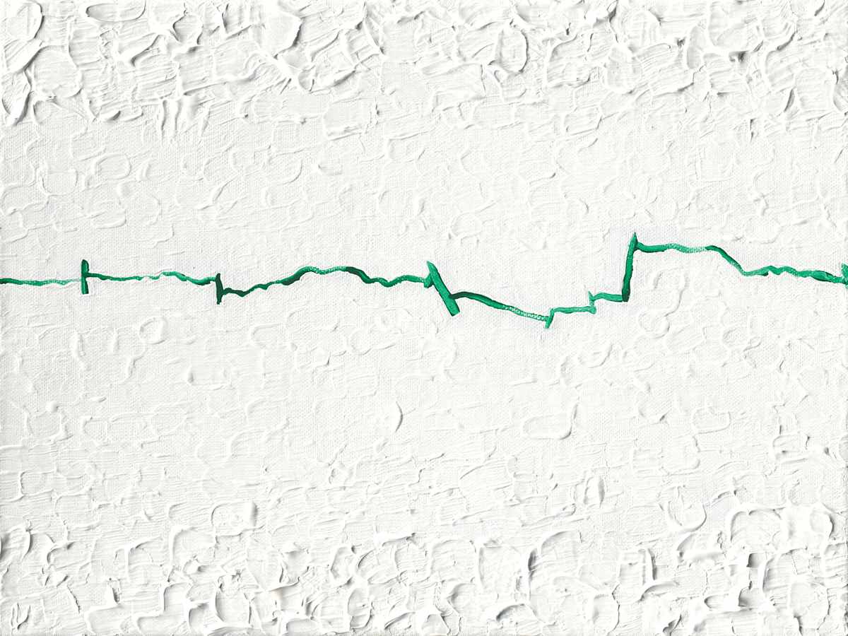 greenLine by Melvyn Poore  Image: A serious crack in a winter landscape. 