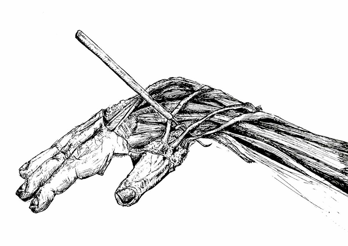 Anatomical snuffbox by Becca Lewis  Image: Available as a print