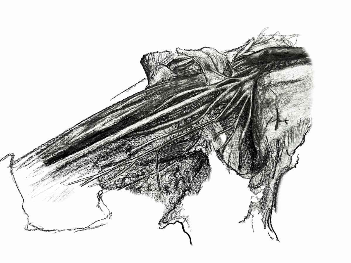 Brachial Plexus by Becca Lewis, Image 1.