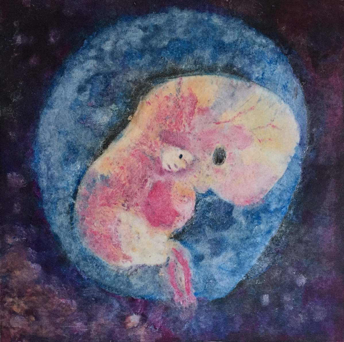 Six Weeks II by MK Wynn, Image 3.