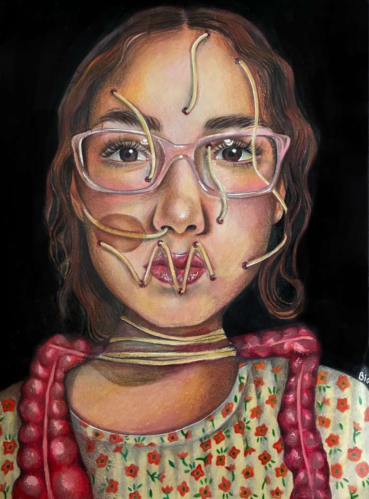 Digested by Beatriz Fraga - Neurosarcoidosis, Image 1.