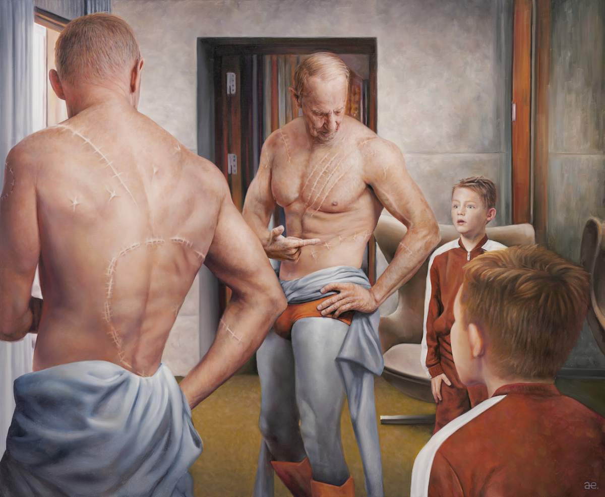 Scars by Andreas Englund, Image 2.