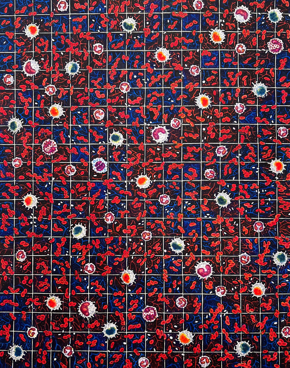 Composition- Blood by Shanthi Chandrasekar 