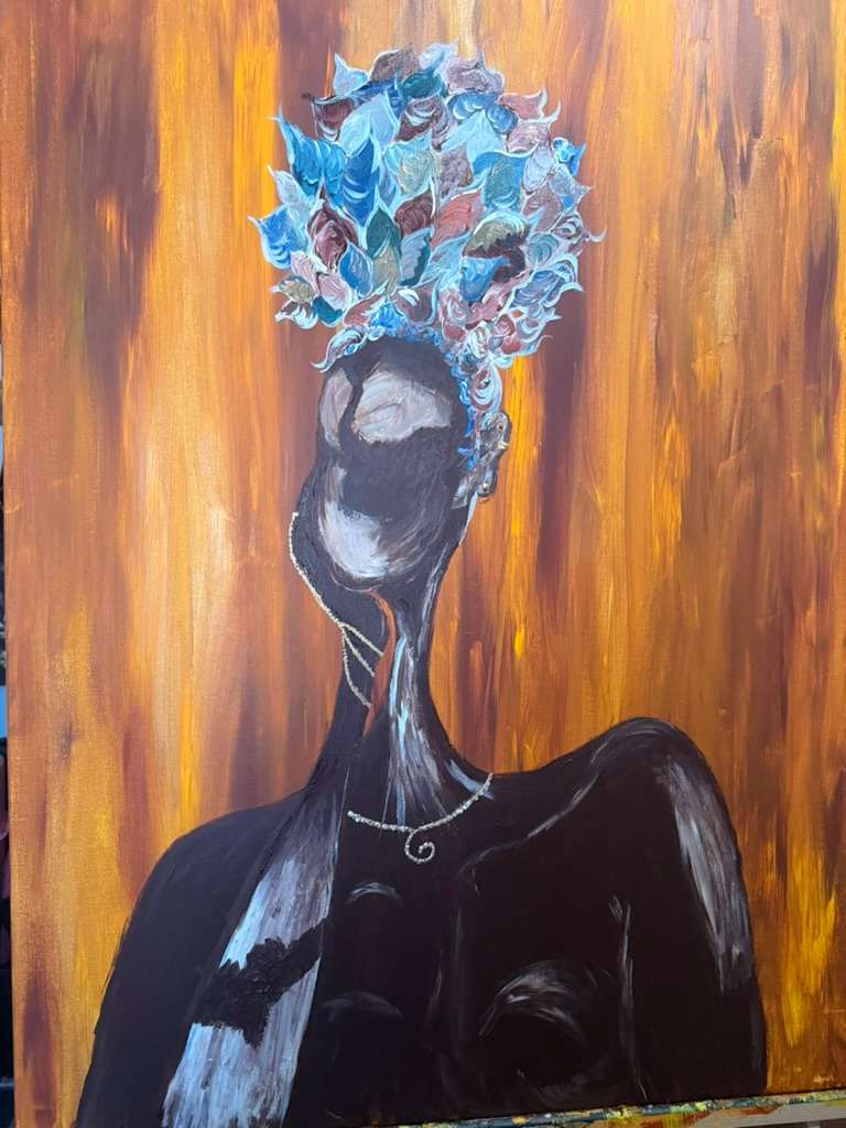 Vitiligo Perfection by Yolanda Patton  Image: Just Beautiful 