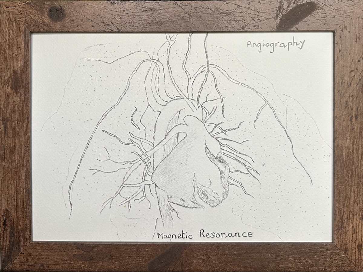 Angiogram by John Simnett 