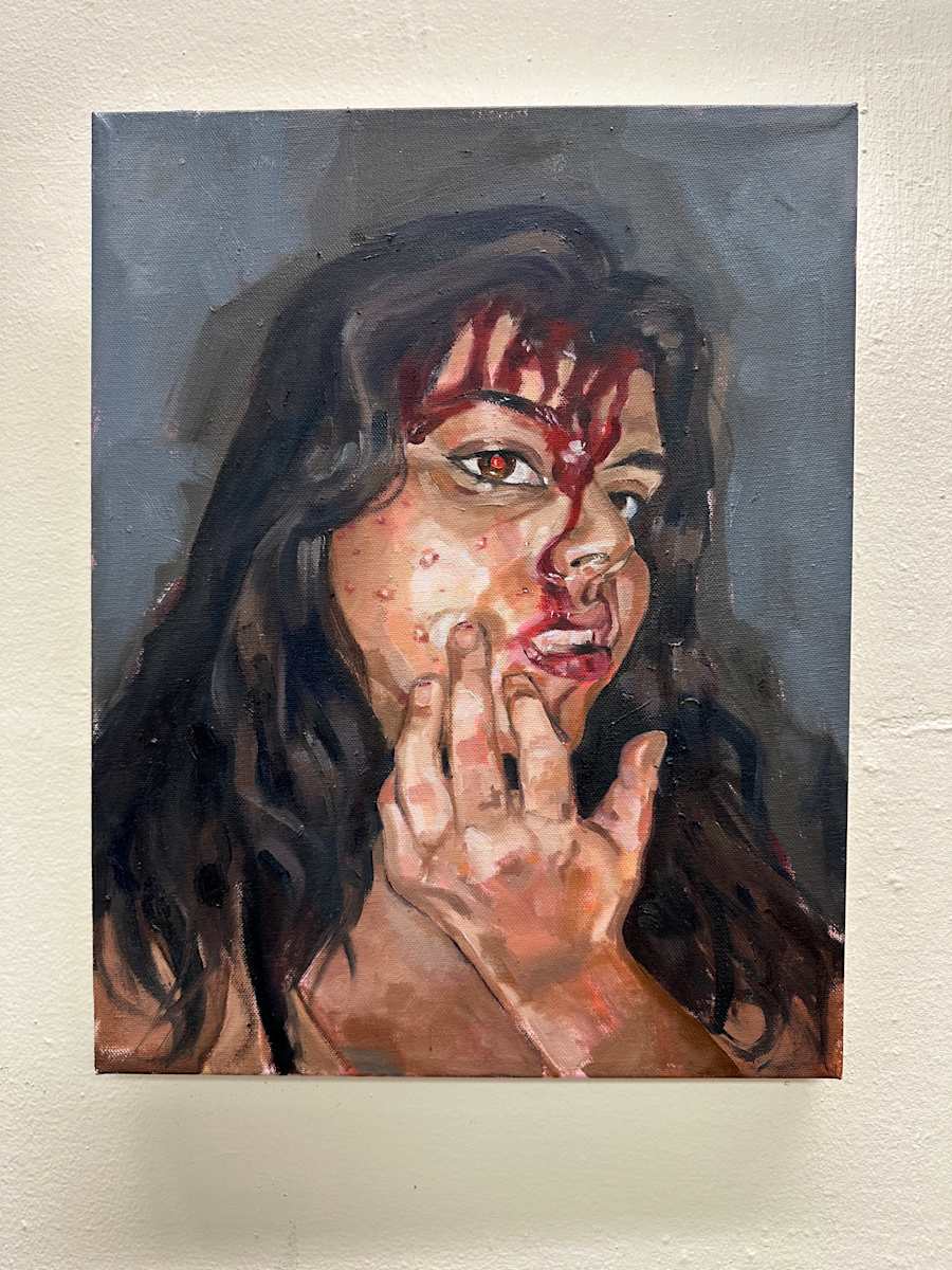 I Told You to Stop Picking! by Abigail Malek, Image 1.