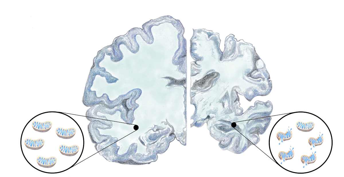 Alzheimer's mitochondrial dysfunction by Shana Katzman, Image 1.