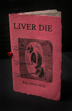Liver Die by Eric Avery 