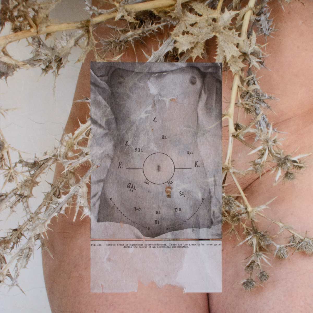 Tenderness by Suzanne Gainer, Image 1.