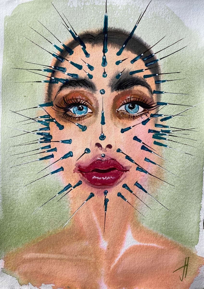 Two years on estrogen. 