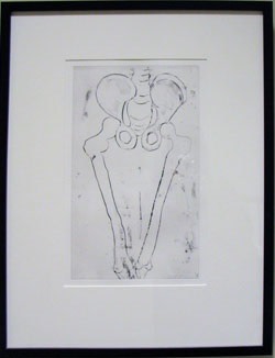 Untitled (from the Anatomy portfolio) by Louise Bourgeois 