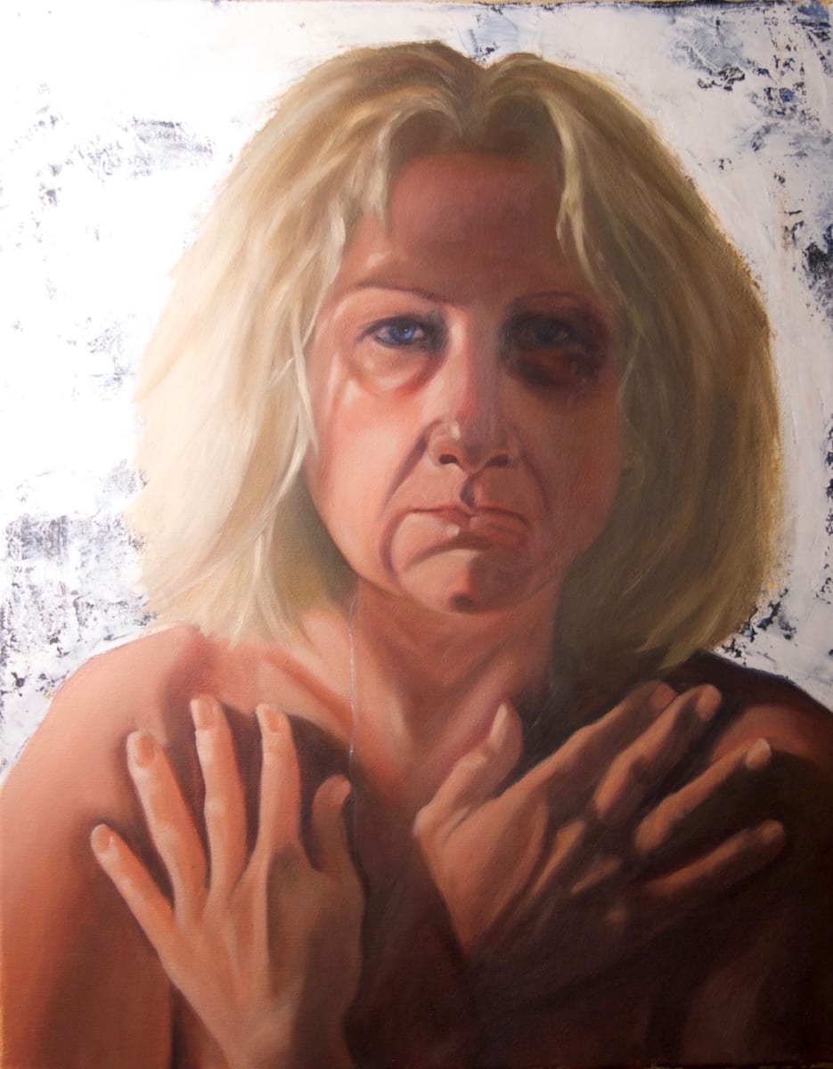 Bruised by Caryn Stromberg, Image 1.