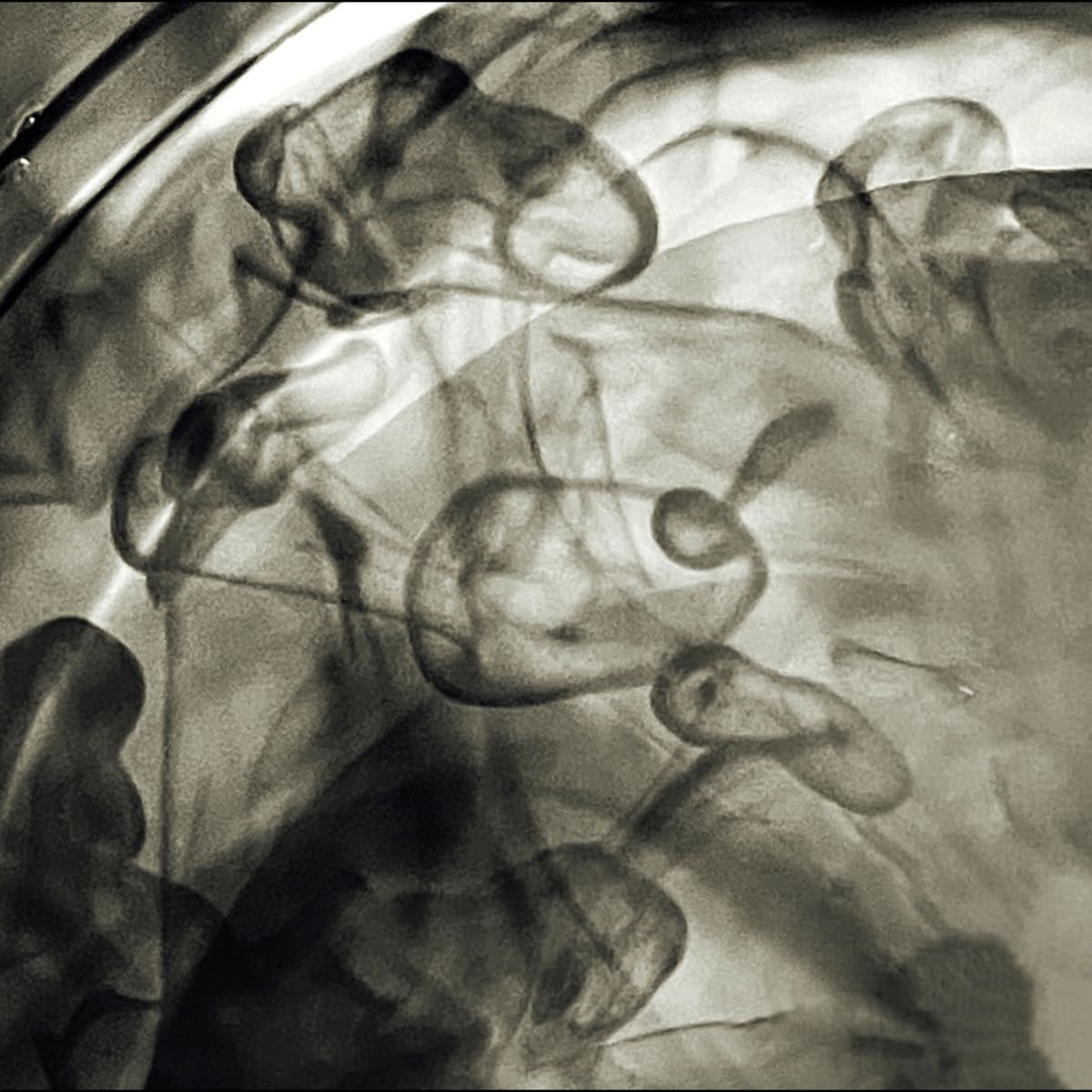 Something in the Water Nº3 by Thia Rice 