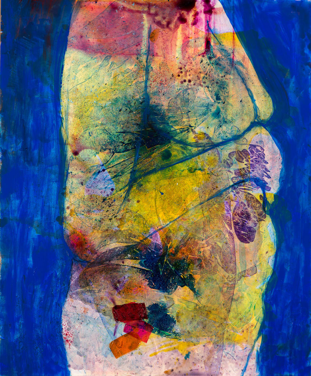 Self portrait with estrogen patch by Éadaoin Glynn, Image 10.