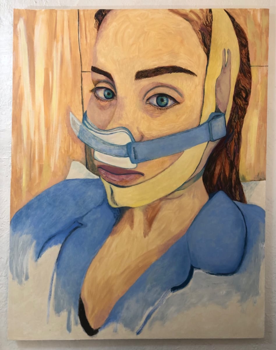 Rhinoplasty by Anna Marie Rockwell 