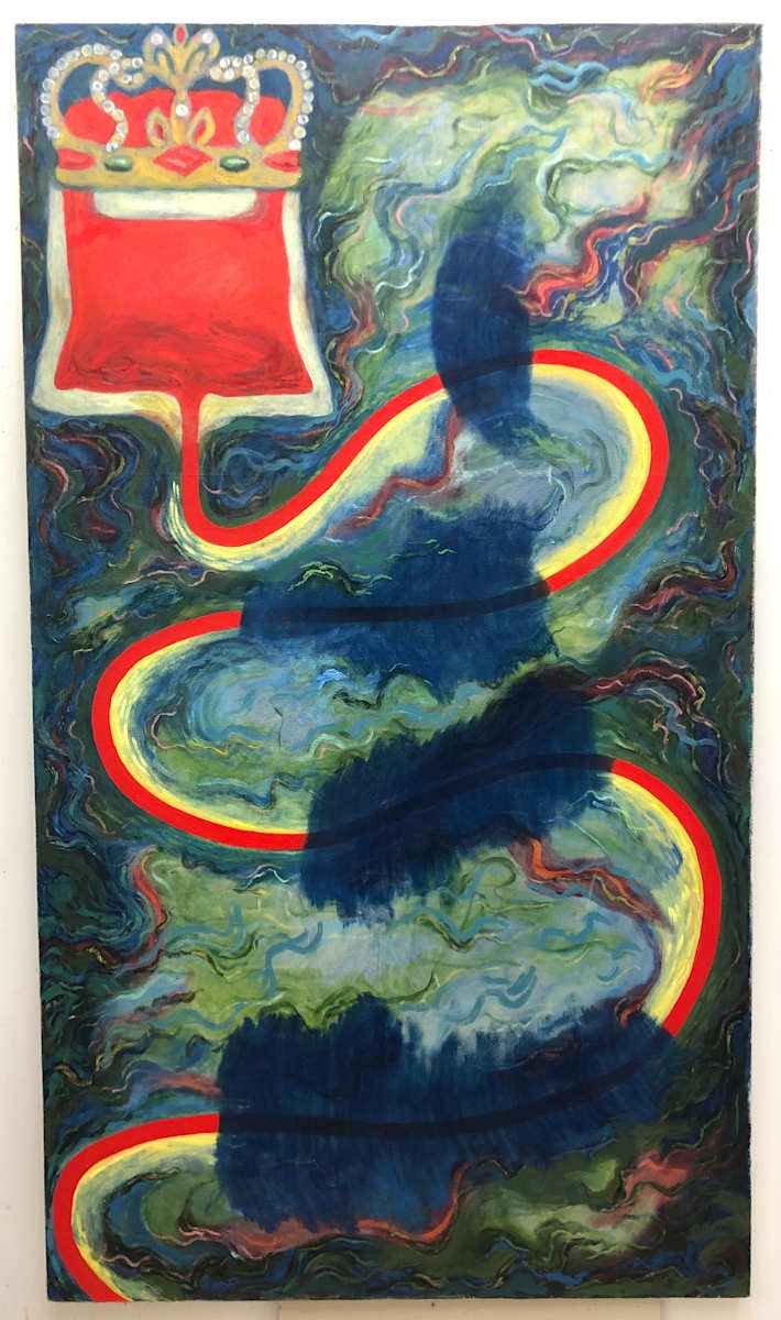 The Transfusion by Anna Marie Rockwell, Image 1.