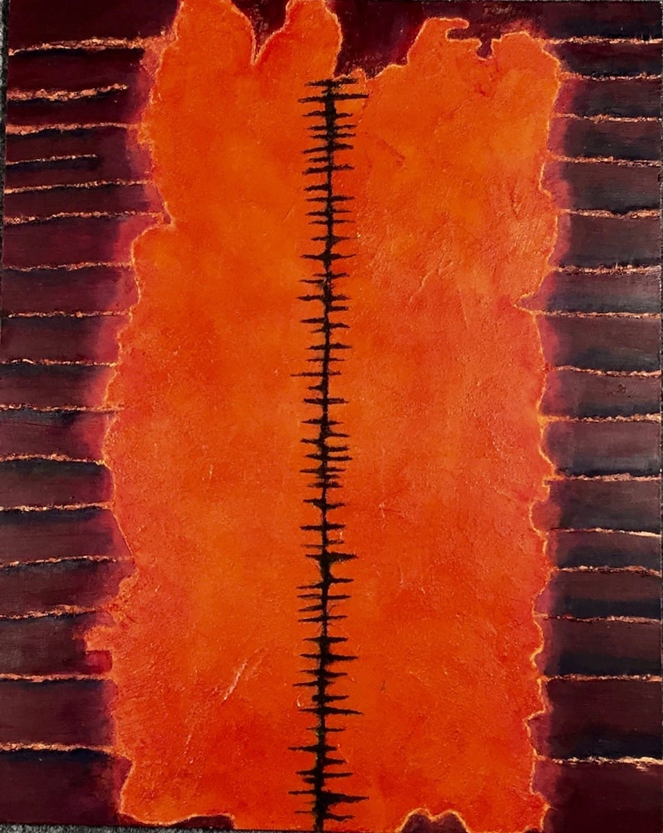 Skin In The Game by Pat Borow, Image 1.