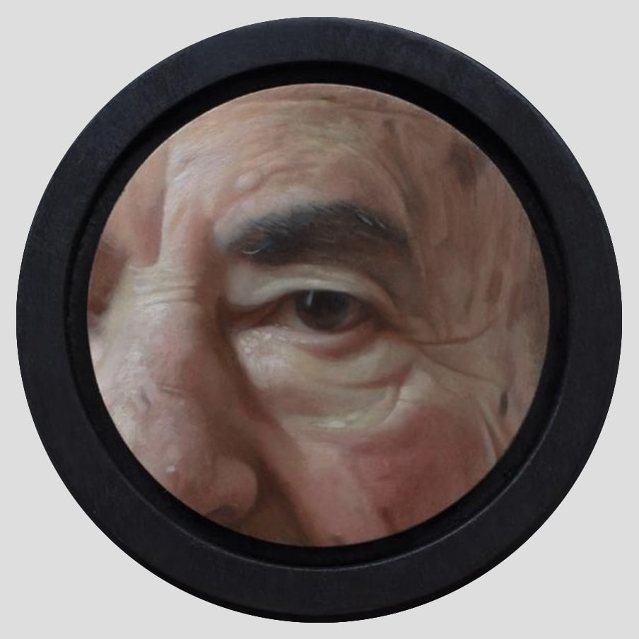 Adam Shtibel's Eye, Image 1.