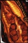 Chrysalis by Gilah Yelin Hirsch 