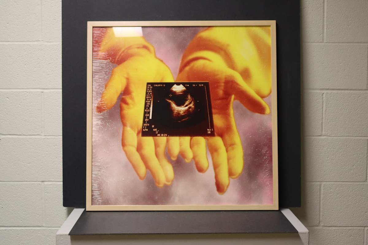 Infertility: Sonogram by Jeri Robinson 