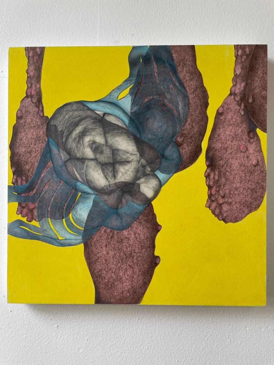 Strange Birth Yellow, Image 1.