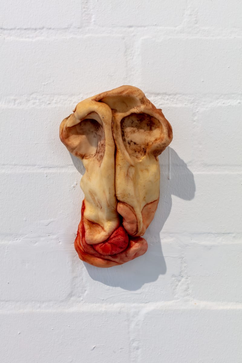 Phantom limbs [Membros fantasma] by Gokula Stoffel 