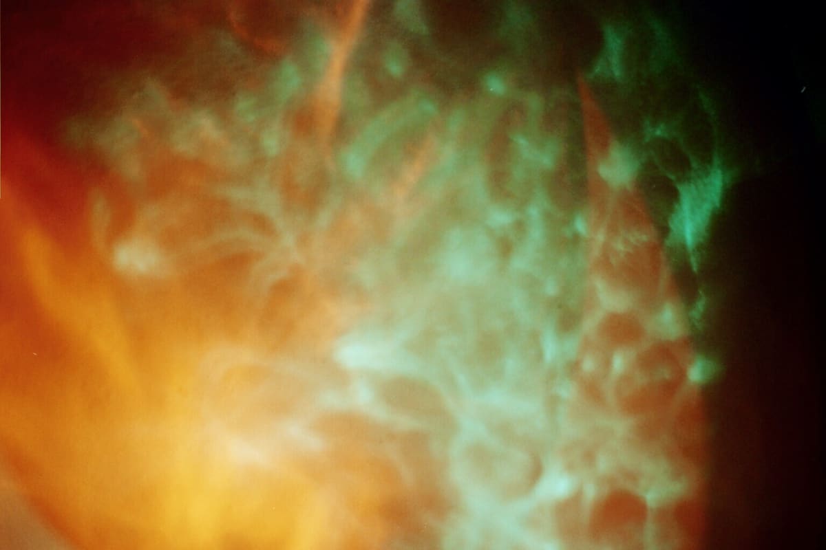 Prism Series 3 (Orb), Image 10.