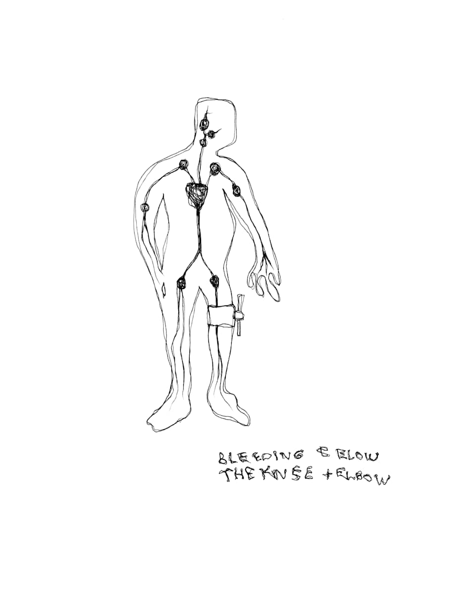 Bleeding Below the Knee and Elbow by Jonathan Canady 