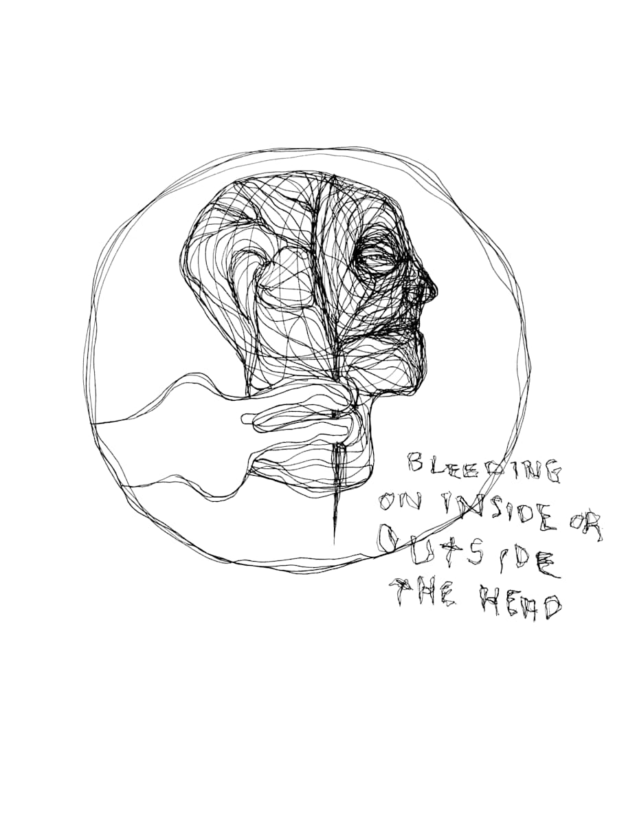 Bleeding on Inside or Outside of Head by Jonathan Canady 