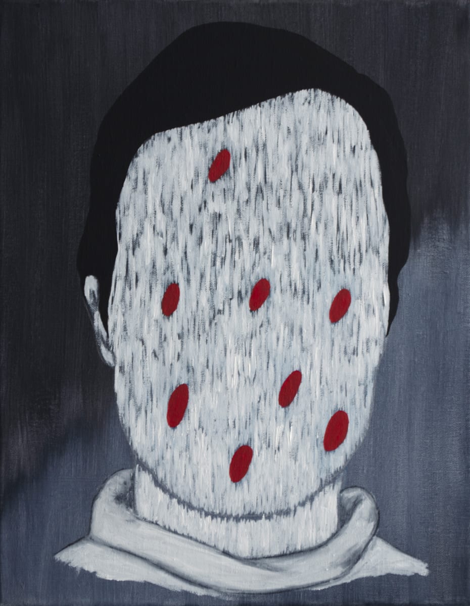 Mosquito Bites by Lee Clarke 