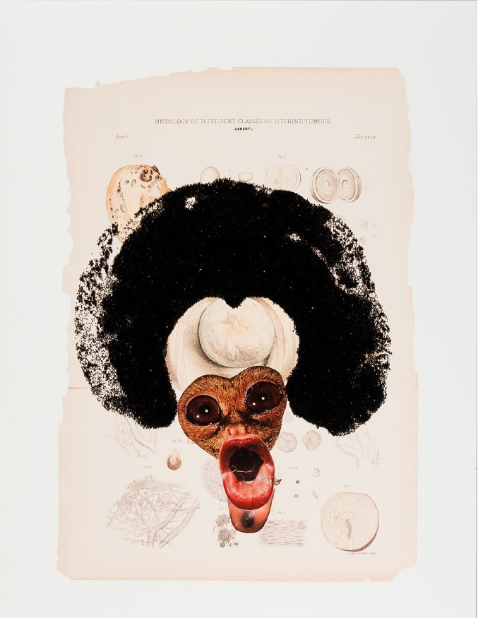 Histology of the Different Classes of Uterine Tumors by Wangechi Mutu, Image 10.