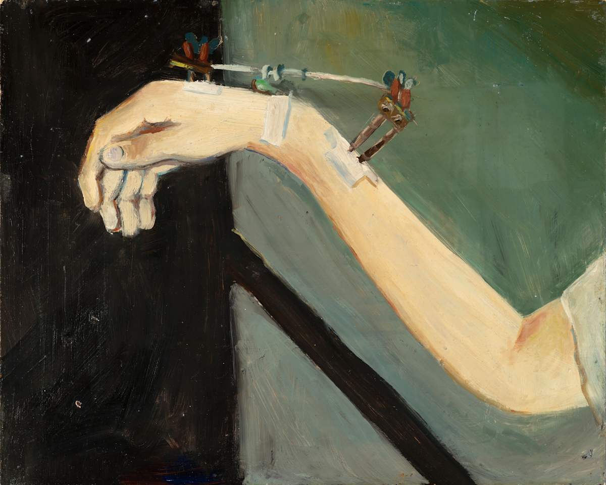 Broken Arm 2 by Cindy Rivarde, Image 2.