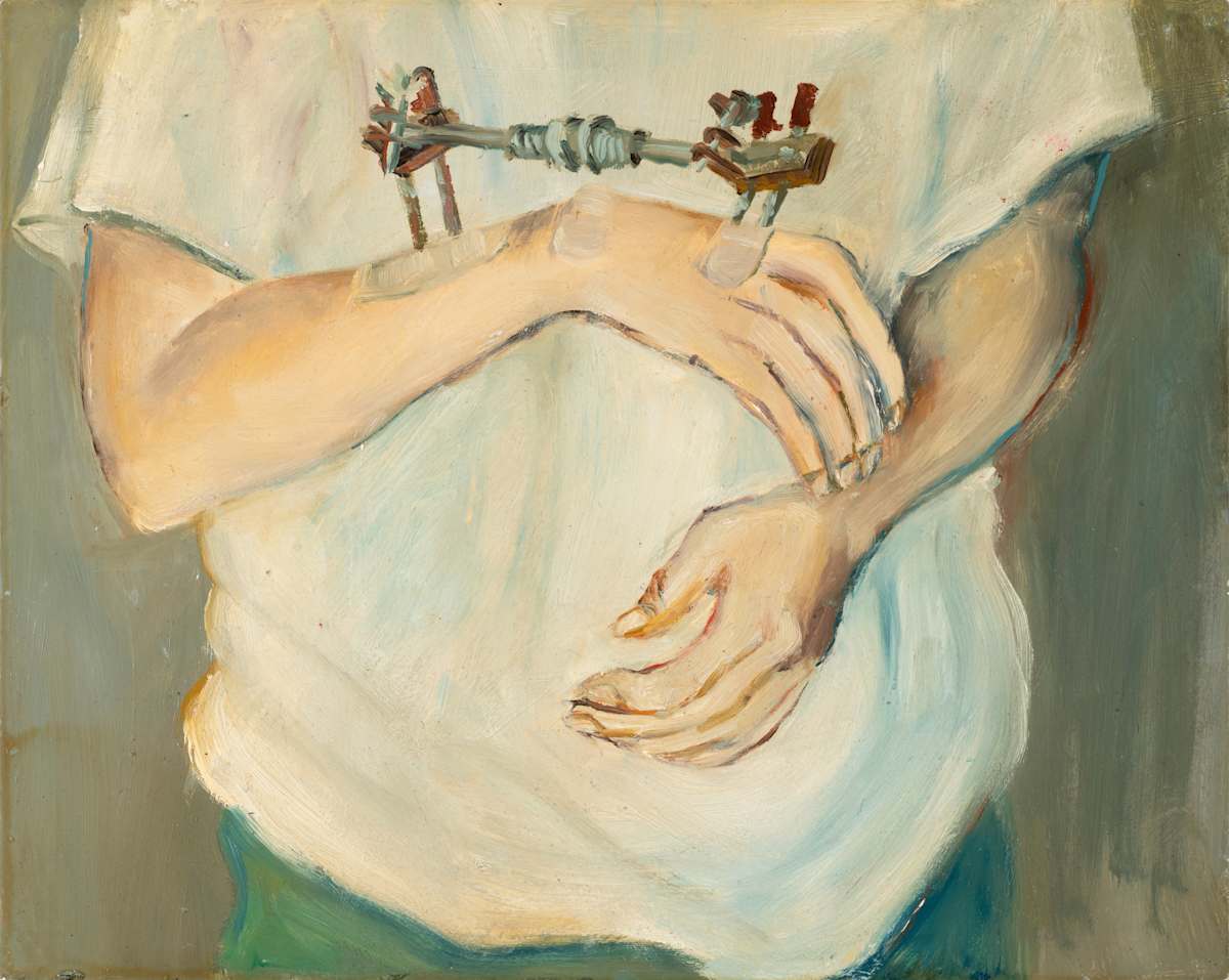 Broken Arm by Cindy Rivarde, Image 2.