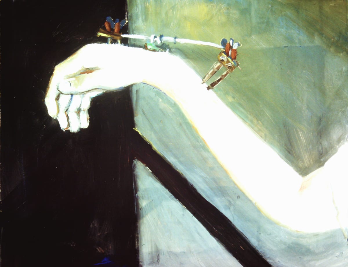 Broken Arm 2 