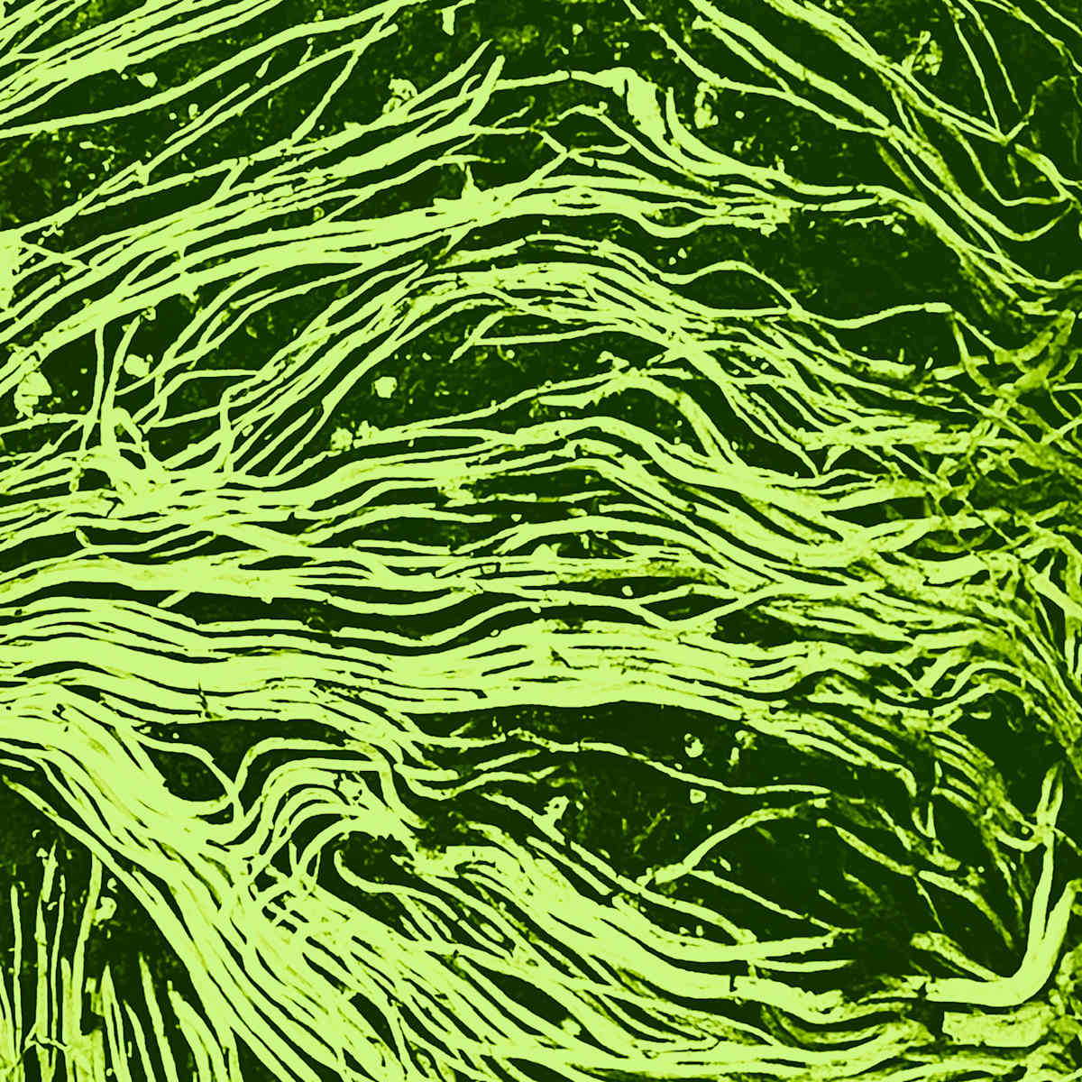 Roots by Roxanne Faber Savage  Image: This submission's portfolio of six images features digital photographic images that focus on interventions in the natural world. As an artist, I am a keen and curious observer of nature. I am fascinated by the essential elements of art that nature shows us, like the tangled lines, bright and glowing colors, and textures that make us look at things in a new way. Once the image is captured, I reimagine the organic form using digital tools to shift one's attention from recognizing what the familiar is to creating uncertainty about it.

Creating these artworks involves digital photography, drawing, and printing onto a Plexiglas mount for display. The artworks are printed directly onto a plexiglass mount, with hanging wire on the verso.