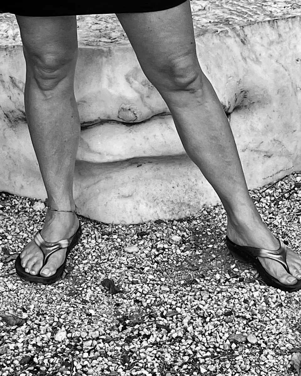 Legs by Alex Damevski, Image 4.