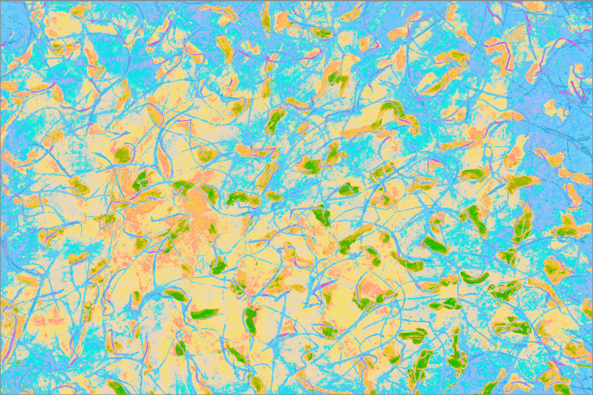 Composition_Day by John Andersen  Image: Beach Days are hard with my injured ankle, but Millie helps to make it fun. Swimming is her second favourite thing to do after chasing the ball. We always feel good having swum as if we have had a make over. Joyous is the sunny beach shore with a ball to chase.