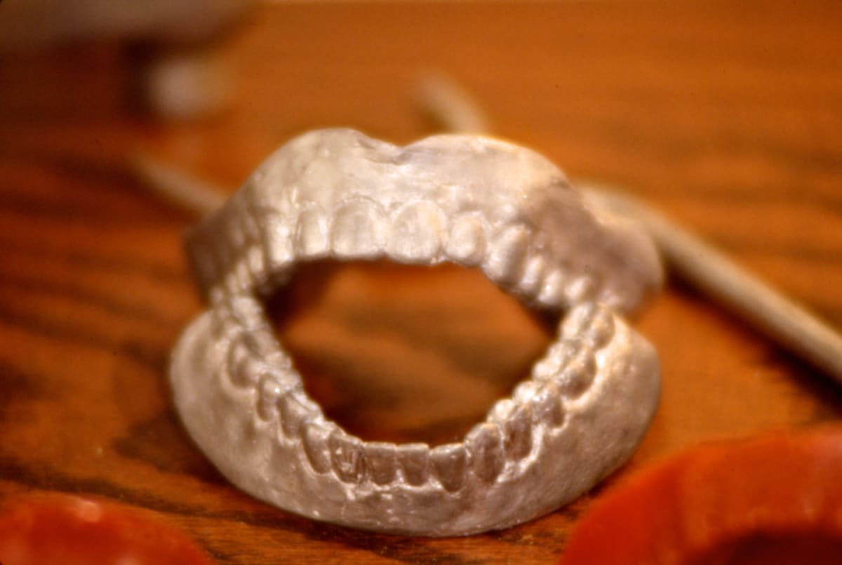 Lead Dentures by Damon Hamm  Image: lead dentures