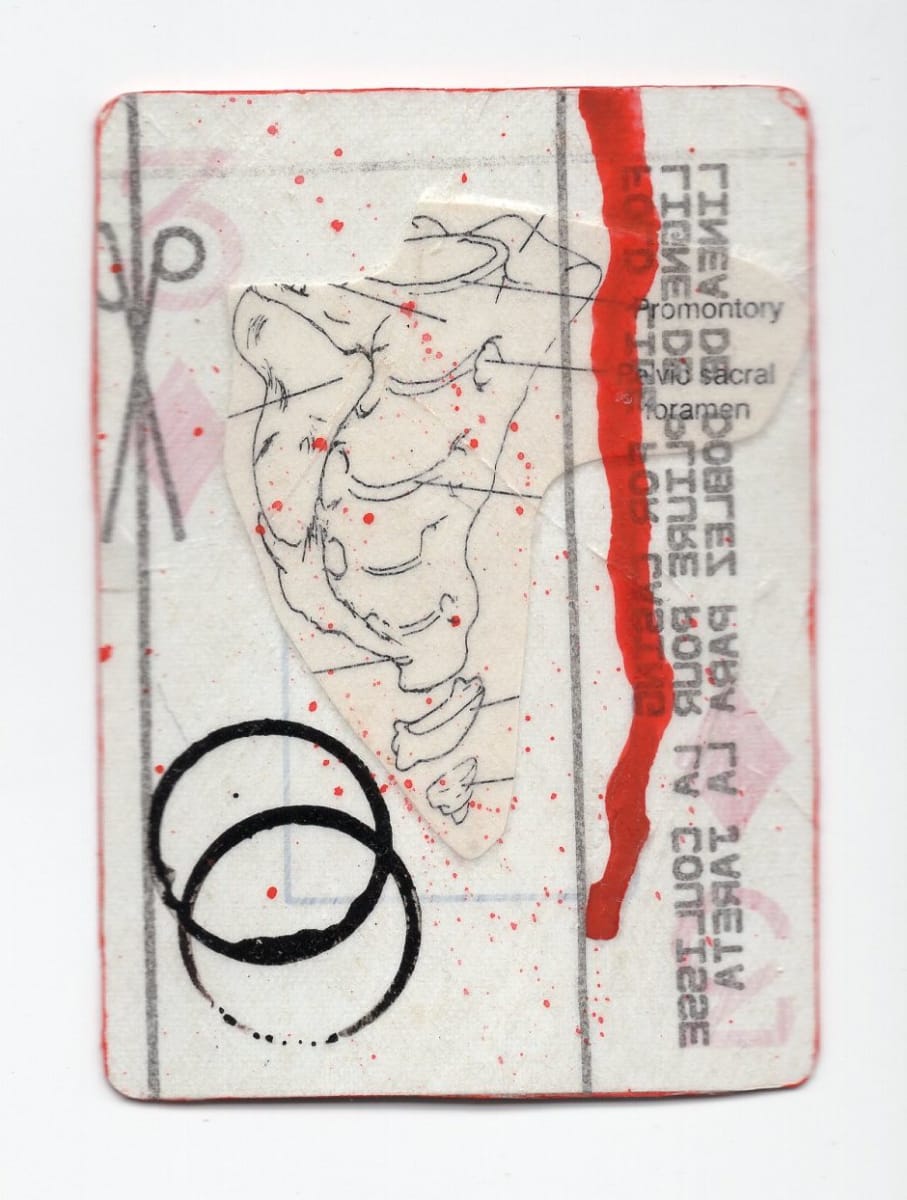3 of Diamonds (Abortion Trading Cards) by Alexandra Jamieson  Image: Front: Human spine layered over with a scissors from a dress pattern and red ink to mimic blood spatter. Red and black borders allude to covert geographic information to find a safe abortion provider. Black circles imply secret identities about the people who made and shared the deck.
