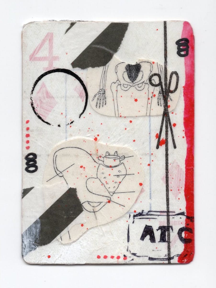 4 of Diamonds (Abortion Trading Cards) by Alexandra Jamieson  Image: Front: Human pelvis overlayed with scissors from an old sewing pattern. Red and black borders, dots, and lines allude to covert geographic information to locate a safe abortion provider. ATC stamp added by a now forgotten teenaged Goth Kid with a sense of gallows humor. 