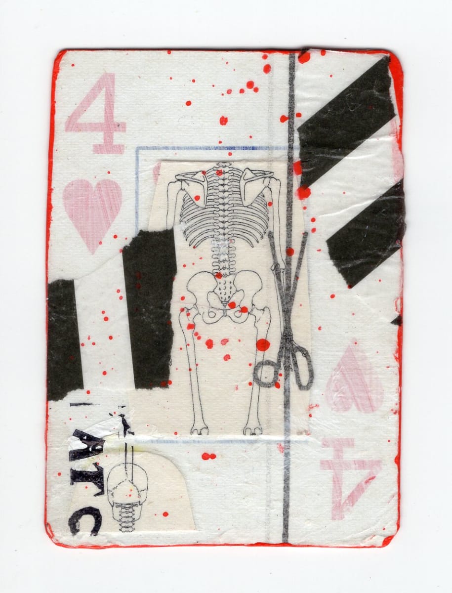 4 of Hearts (Abortion Trading Cards) by Alexandra Jamieson  Image: Front: Decapitated human skeleton overlayed with scissors from an old dress pattern and red ink to mimic blood spatter. Red borders and black lines allude to geographic information pointing people to a safe abortion provider in a now unknown place. ATC stamp added by a now forgotten teenaged Goth Kid with a sense of gallows humor.
