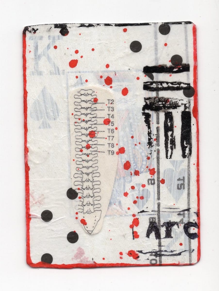 King of Spades (Abortion Trading Cards) by Alexandra Jamieson  Image: Front: Human spine overlayed with old sewing pattern. Black and red borders and lines allude to geographic information pointing people to a safe abortion provider in a now unknown place.