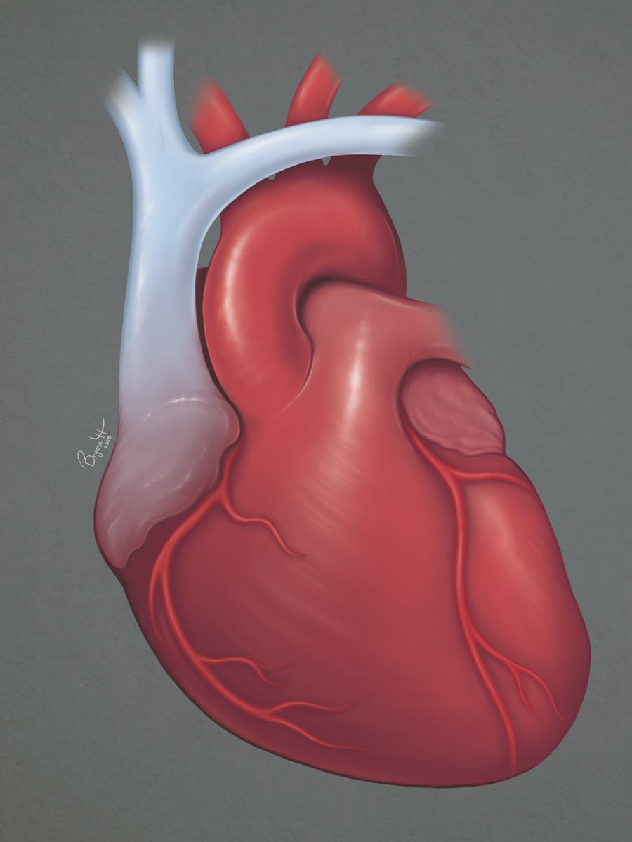 Anatomical Heart by Bryona Hamilton, Image 1.