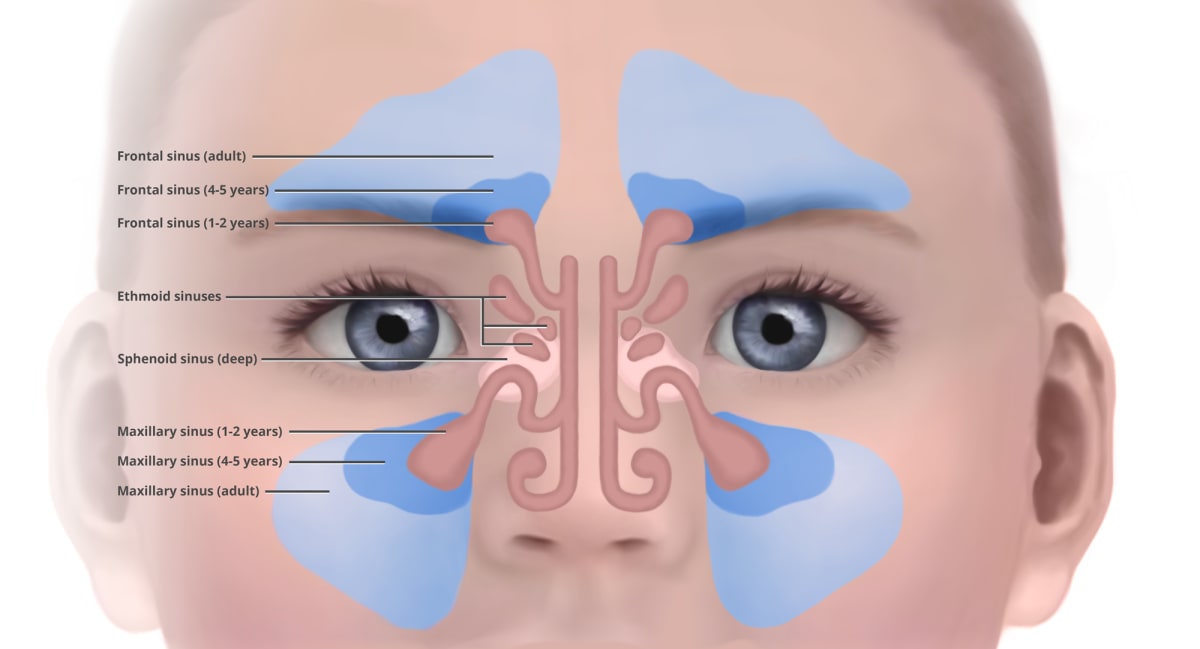 Pediatric Sinuses by Caitlin Rausch 