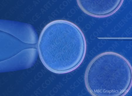 Somatic Cell Nuclear Transfer by Erica Beade 