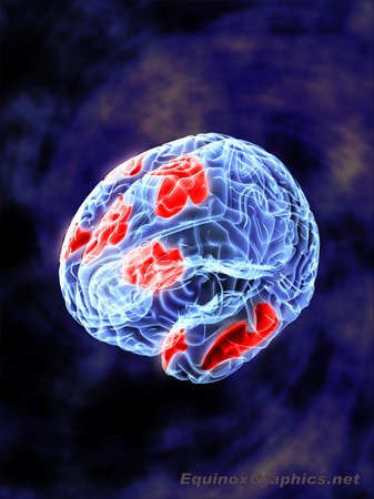 Brain Stimulation by Dr Jon Heras 
