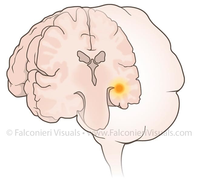 Brain Cross Section - Hippocampus by Veronica Falconieri Hays 