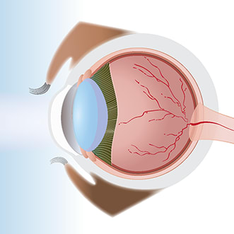 Profile of eye by Nicoletta Barolini 