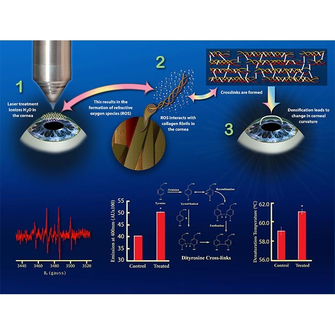 Non-laser corneal adjustment by Nicoletta Barolini 