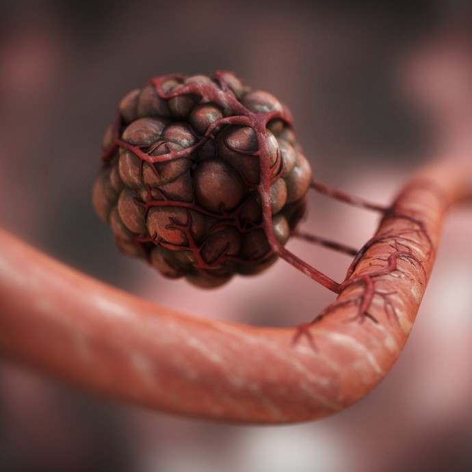 Tumor-driven Angiogenesis by Dr Jon Heras 